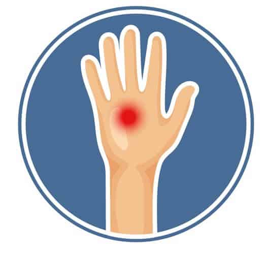 En tegnet hånd fra et menneske med et rødt smerte - skades punkt vist på hånden.